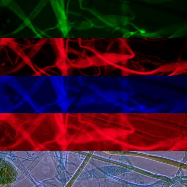 OPTIKA B-510FL Trinoküler Floresan Mikroskop - Araştırma Mikroskobu 400x