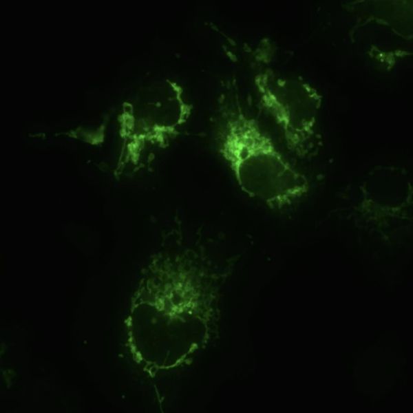 OPTIKA B-293LD1.50 Trinoküler Floresan Mikroskop IOS Sistem - Araştırma Mikroskobu 500x