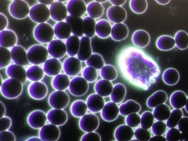 OPTIKA B-383DK Trinoküler Karanlık Alan Mikroskobu - Kan Analiz Araştırma Mikroskobu