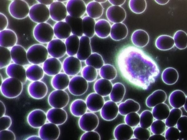 OPTIKA B-383DK Trinoküler Karanlık Alan Mikroskobu - Kan Analiz Araştırma Mikroskobu