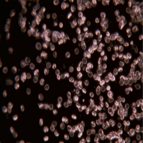 OPTIKA B-383DK Trinoküler Karanlık Alan Mikroskobu - Kan Analiz Araştırma Mikroskobu