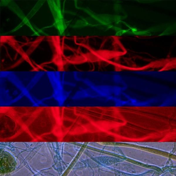 OPTIKA B-383FL Trinoküler Floresan Mikroskop Civa Buharlı - Araştırma Mikroskobu 1000x