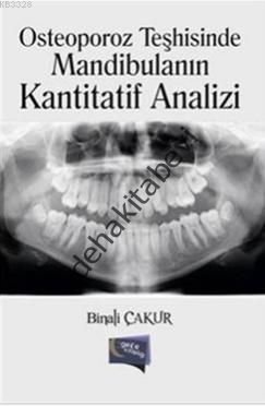 Osteoporoz Teşhisinde Mandibulanın Kantitatif Analizi, Binali Çakur