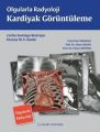 Olgularla Radyoloji Kardiyak Görüntüleme, Erhan Akpınar