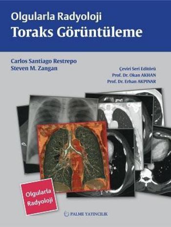 Olgularla Radyoloji Toraks Görüntüleme, Erhan Akpınar