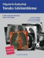 Olgularla Radyoloji Toraks Görüntüleme, Erhan Akpınar