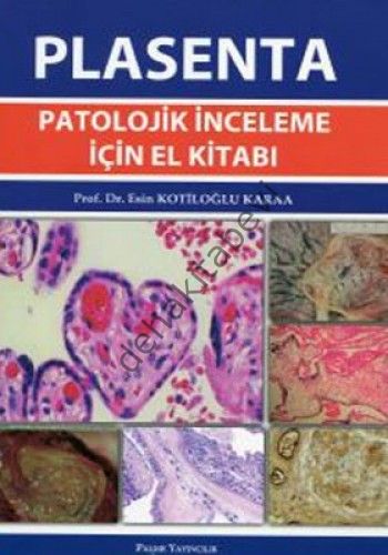 Plasenta Patolojik İnceleme İçin El Kitabı - Esin Kotiloğlu Karaa