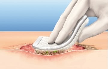 Debrisoft Debridman Pedi 10x10cm Steril