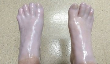 Fizik Tedavi Parafin Kazanı 13L