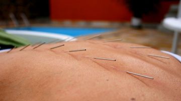 SMC Çelik Akupunktur İğnesi