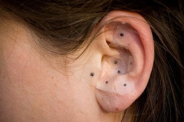 Ear Seeds Kulak Tohumu 100 Adet