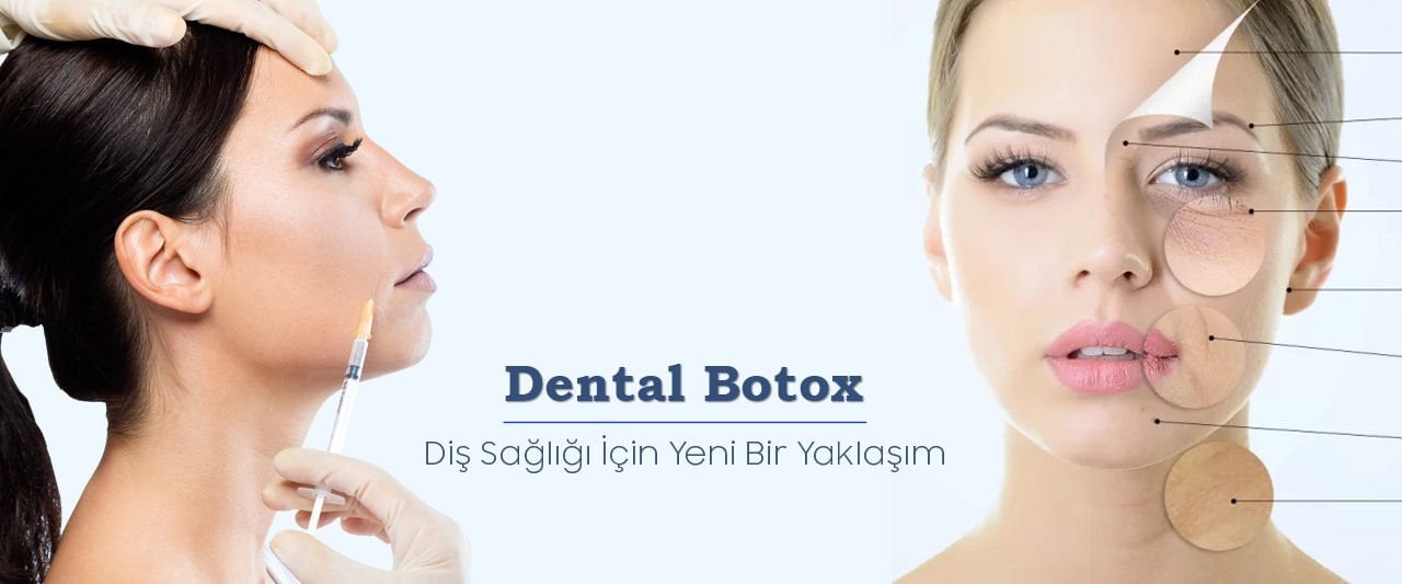 Dental Botox: Diş Sağlığı İçin Yeni Bir Yaklaşım