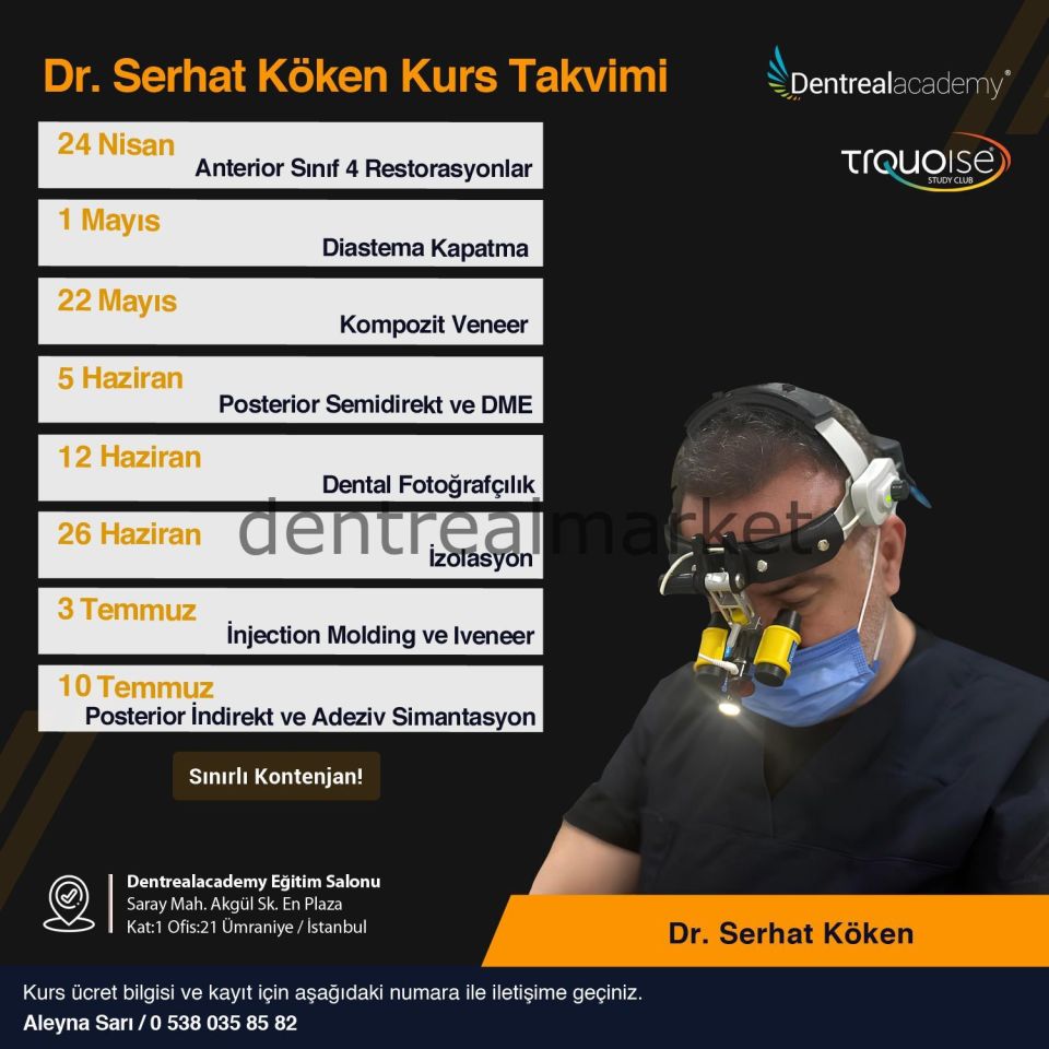 Kompozit Veneer - Dr. Serhat Köken