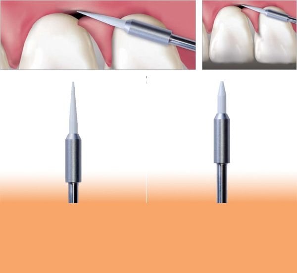 Gingiva Trimmer Yumuşak Doku Frez Seti