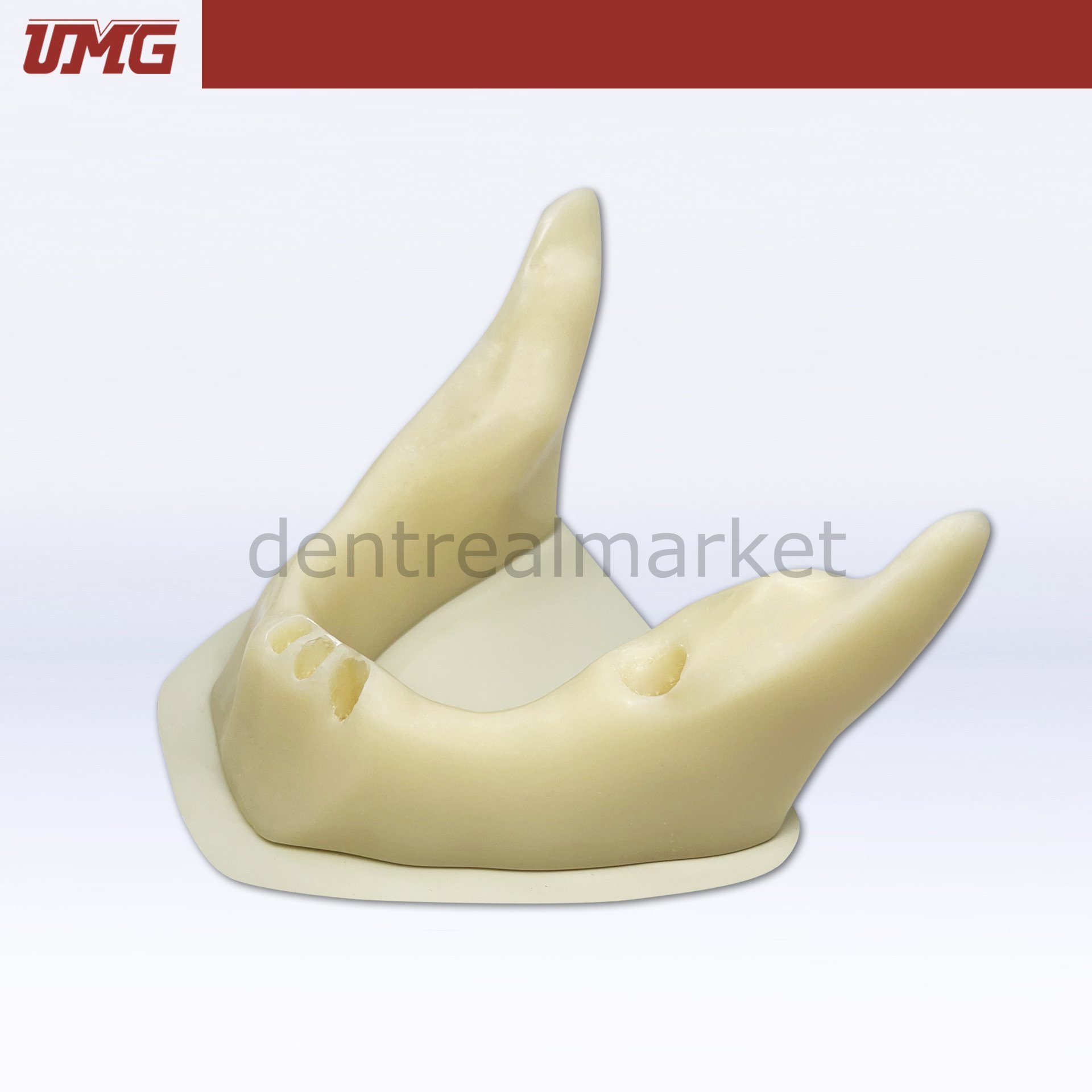 İmplant Yerleştirme Uygulaması için Anatomik Şekilli Kemik Mandibula