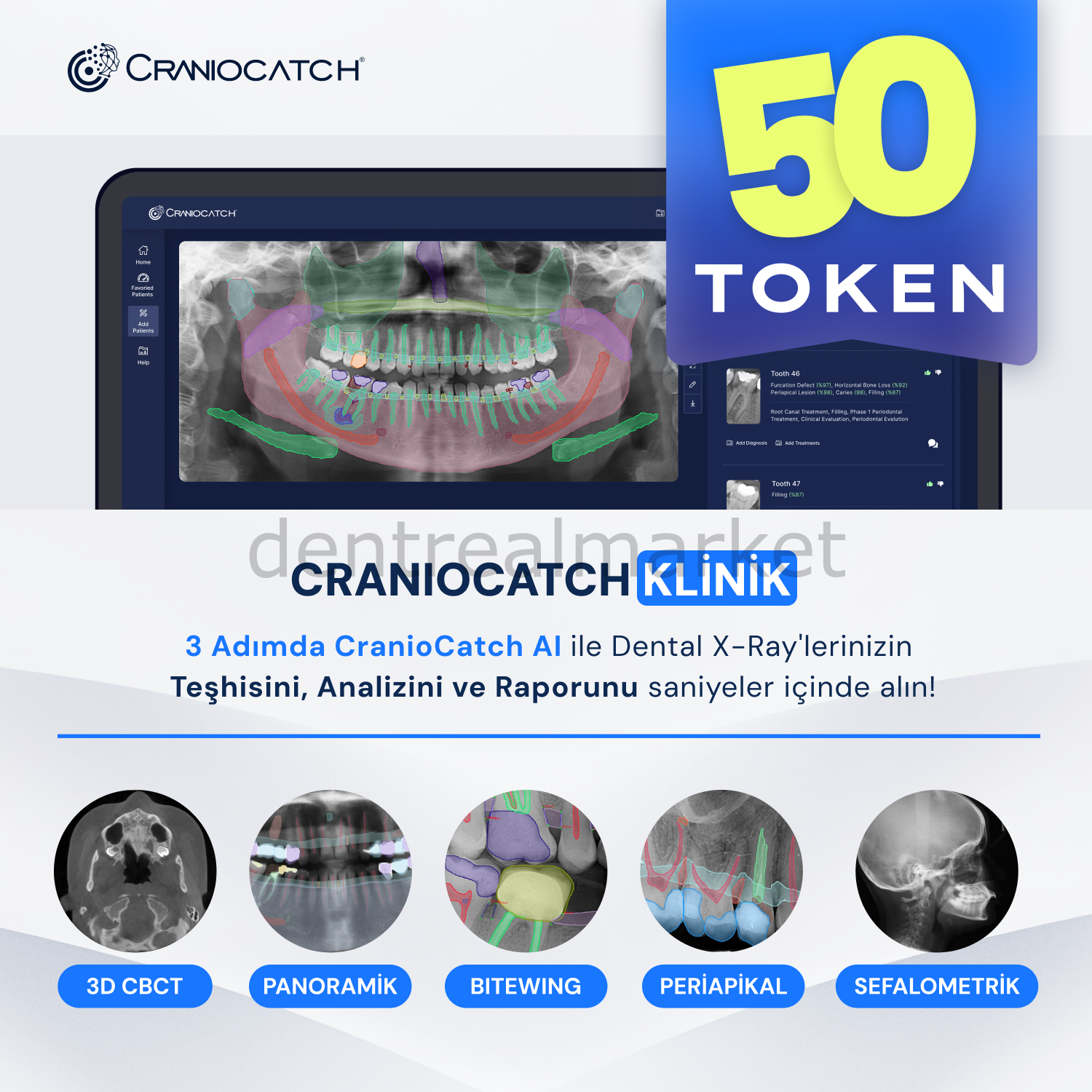 AI ile Dental X-Ray İçin Teşhis, Analiz ve Rapor - 50 Token