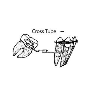 Cross Tubes Tüp - 1 Adet