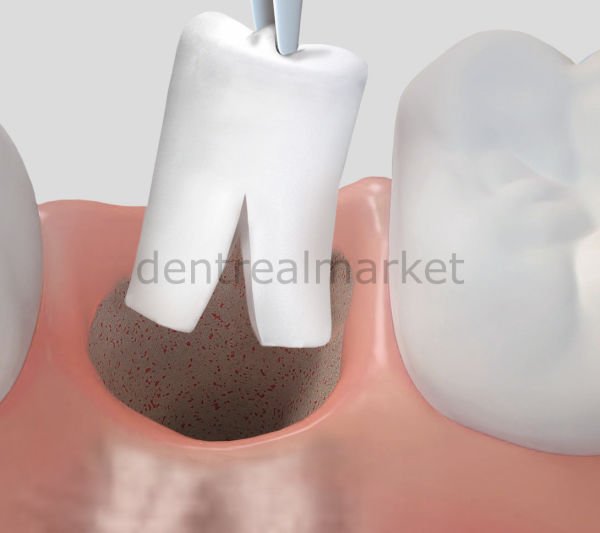 Parasorb Collagene Cone Genta- Antibiyotikli Cone