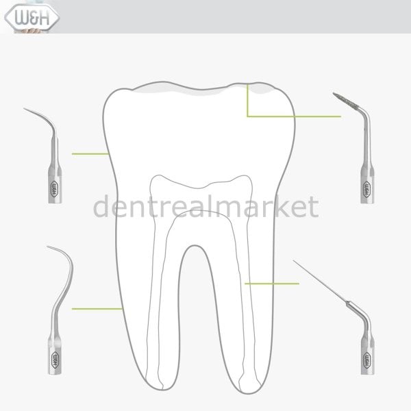 Kavitron-Scaler Uç Refilleri