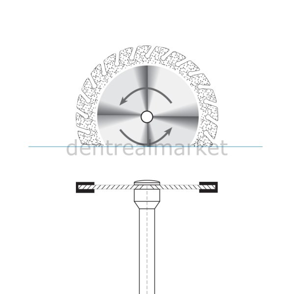 Ortho Diamond Disc Arayüz Separe - Çift Taraflı Aşındırma