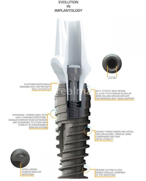 Titanyum İmplant ve Üst Yapı Dahil Çap:3,5 mm