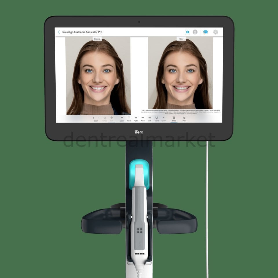 Element 5D Plus Cart İntraoral Scanner - iTero Ağız İçi Tarayıcı