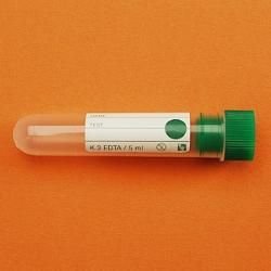 K3 EDTALI Tüp, 5 ml, 16x75 mm - 1000 Ad.