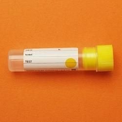 Sodyum Sitratlı Tüp, 0.4 ml, 16x60  mm, Sarı - 50 Ad.