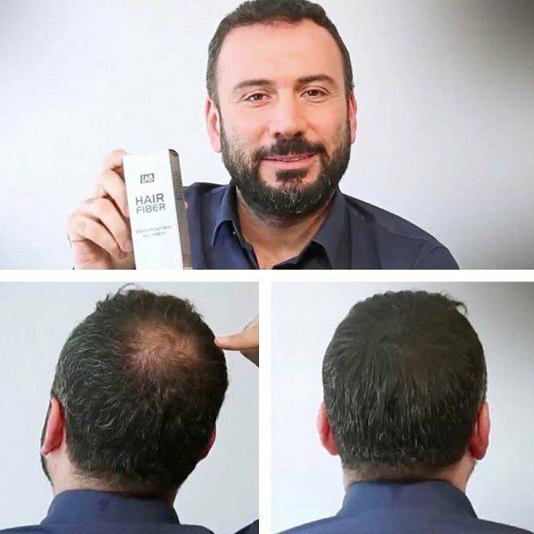 Luis Bien Hair Fiber Dolgunlaştırıcı Siyah Saç Sprey 100 Ml