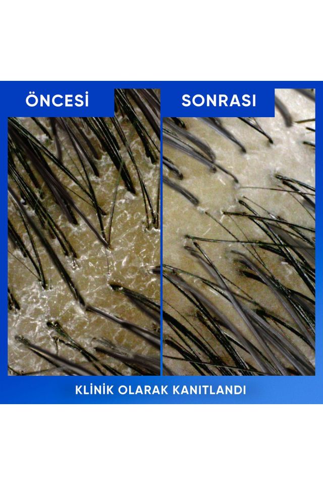 Head Shoulders Şampuan 800 Ml Arındırma ve Parlaklık Kepeğe Karşı Etkili Pompalı