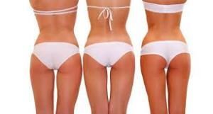 Nivea Q10 Body Plus Bel,Kalça,Basen Bölgesi Şekillendirici Krem 300 Ml