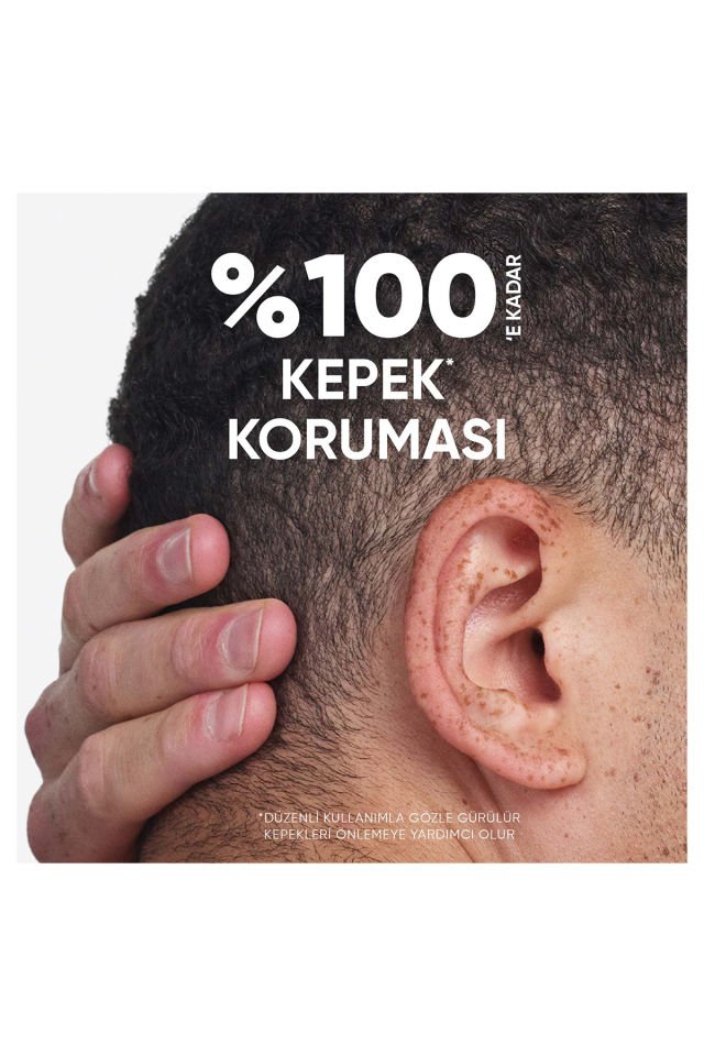 Head Shoulders 2ın 1 Şampuan 300 Ml Limon Ferahlığı + Kepek