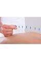 Akupunktur Iğnesikuru Iğne,acupuncture Needle 0.35*100mm